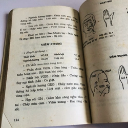 CHÂM CỨU TRỊ DI CHỨNG VIÊM NÃO 548619