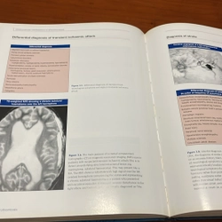 PICTURE BOOK Atlas of atherothrombosis 536358