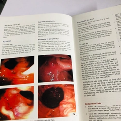 📚 SỎI ĐƯỜNG MẬT – Nguyễn Đình Hối, Nguyễn Mậu Anh 539457