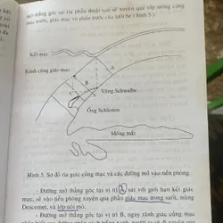 Giáo trình nhãn khoa, Nguyễn Xuân Trường 713182