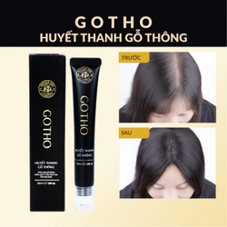 Gotho Huyết thanh gỗ thông Huyền Phi- 30ml-  kích thích mọc tóc, chống gãy rụng