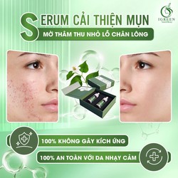 Sỉ 3 serum diếp cá IGREEN  8272