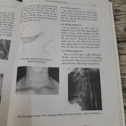 TAI MŨI HỌNG NHẬP MÔN- Phó GS Tiến sỹ NHAN TRỪNG SƠN. 788006