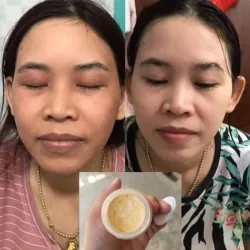 Kem trị nám, thâm xách tay Hàn Quốc 971583