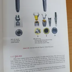 CẤY GHÉP NHA KHOA 740877