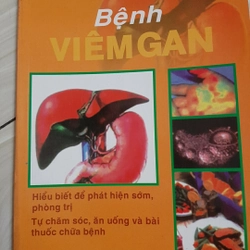 Bệnh Viêm GAN 324005