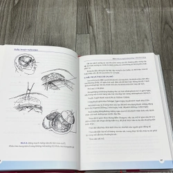 Phẫu thuật thần kinh. 8a1 539056