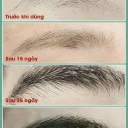 Dưỡng dày mày 971553