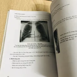 BÀI GIẢNG CHẨN ĐOÁN X QUANG 1013046