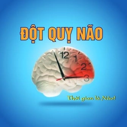Đột Quỵ Não