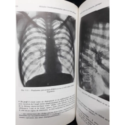 Pneumologie mới 80% bẩn bìa, ố vàng HCM1410 J.Chretien - J.Marsac HỌC NGOẠI NGỮ 340168
