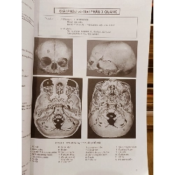 Hình ảnh học sọ não - Jacques Clarisse, Nguyễn Thi Hùng, Phạm Ngọc Hoa