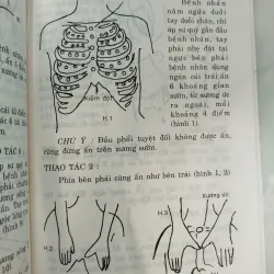 ĐỒ GIẢI CHỈ ÁP TRỊ LIỆU PHÁP - LÃNG VIỆT, PHẠM CAO HOÀN 996096