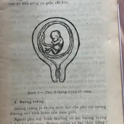 Những bệnh phụ khoa thông thường, Dương Thị Cương 622727