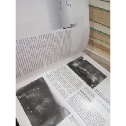 Operative otolaryngology: Head and neck surgery - Eugene N. Myers 792180