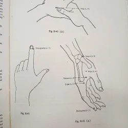 ACUPUNCTURE MERIDIAN THEORY AND ACUPUNCTURE POINTS 557378