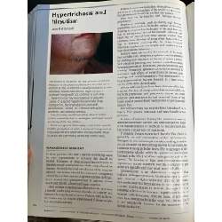 Treatment of skin Disease 738446