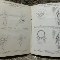 Kthuật phẫu thuật bằng hình ảnh -TECHNIQUE CHIRURGIEALE EN FIGURES G.JEANNENEY& J.MAGENDIE 1006345