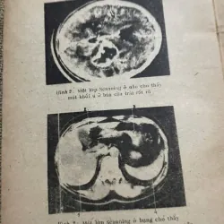 BỆNH LÝ NGOẠI KHOA THẦN KINH - SÁCH Y 571834