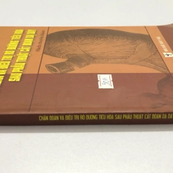 CHẨN ĐOÁN VÀ ĐIỀU TRỊ RÒ ĐƯỜNG TIÊU HÓA SAU PHẪU THUẬT CẮT ĐOẠN DẠ DÀY  315401