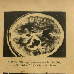 Bệnh lý ngoại khoa thần kinh, Lê Xuân Trung, lưu hành nội bộ 709163