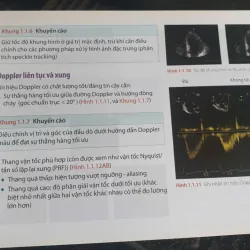 Sổ Tay Siêu Âm Tim - Patrizio Lancellotti, Bernard Cosyns mới 90% 752435