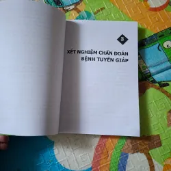 Tìm hiểu bệnh bướu cổ 790886