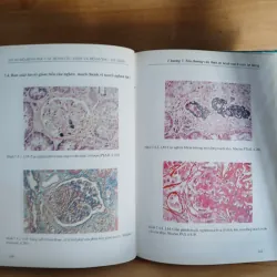 Atlast Mô Bệnh Học Các Bệnh Cầu Thận & Bệnh Ống - Kẽ Thận 799329