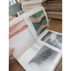 Diagnostic picture tests in injury in sport - J.G.P. Williams 1026695