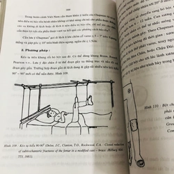 CHẤN THƯƠNG HỌC VÙNG HÁNG ( Lê Phúc ) 539414