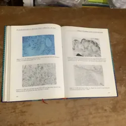 ATLAS MÔ BỆNH HỌC CÁC BỆNH CẦU THẬN & BỆNH ỐNG - KẼ THẬN 935201