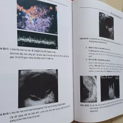 SIÊU ÂM TỔNG QUÁT  957610