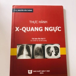 THỰC HÀNH X- QUANG NGỰC