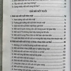 GIẢI MÃ NỐT RUỒI 759880