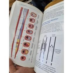 ESSENTIAL HYPERTENSION (2013) - John M. Cruickshank 138250