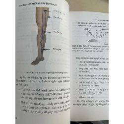 Góc nhìn lão khoa về suy tĩnh mạch - Nguyễn Văn Trí 1012987