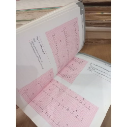The ECG in practice - John R. Hampton 992671