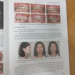 CHỈNH NHA LÂM SÀNG TẬP 1 689476