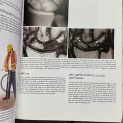 Atlas y khoa Hội chứng đau hiếm gặp  715543