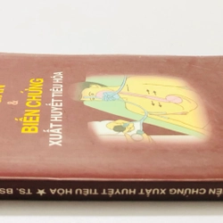 XƠ GAN & BIẾN CHỨNG XUẤT HUYẾT TIÊU HOÁ - 180 trang, nxb: 2001 360578