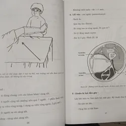 GÃY THÂN XƯƠNG ĐÙI - TỔN THƯƠNG, CHẨN ĐOÁN, ĐIỀU TRỊ 595415