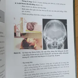 KỸ THUẬT CHỤP X QUANG 738448