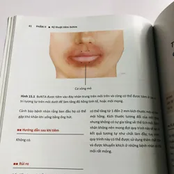 KỸ THUẬT TIÊM THẨM MỸ  600130