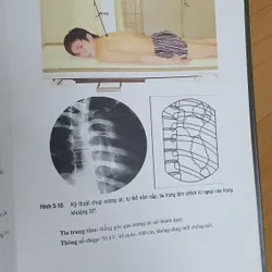 KỸ THUẬT CHỤP X QUANG 738448