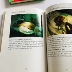 PHẪU THUẬT NỘI SOI LỒNG NGỰC  675226