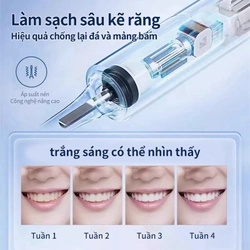 Bàn chải điện thông minh 308876