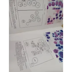 Atlas of Haematology - McDonald, Dodds, Cruickshank 575853