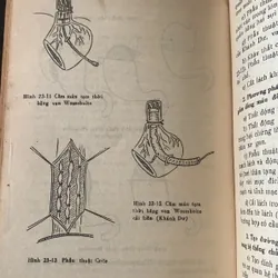 Bài giảng bệnh học ngoại khóa tập 1 - 2, lưu hành nội bộ 709608