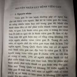 Bệnh viêm gan - Jia Da Xiong 1029220