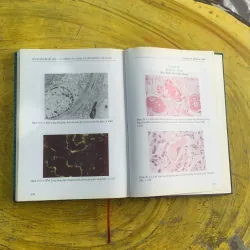 ATLAS MÔ BỆNH HỌC CÁC BỆNH CẦU THẬN & BỆNH ỐNG - KẼ THẬN 1009009